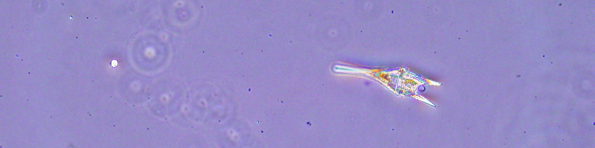 IMS-image-of-dinoflagellate-collected-from-the-neuse-river-estuary